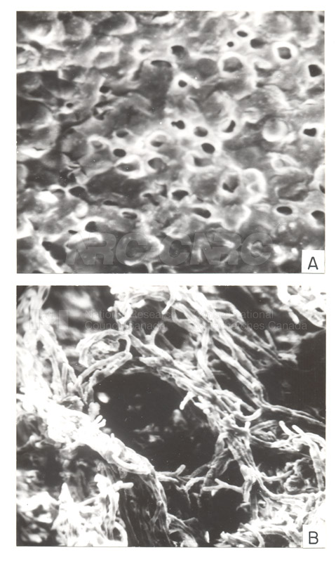 Lichens W. Maass